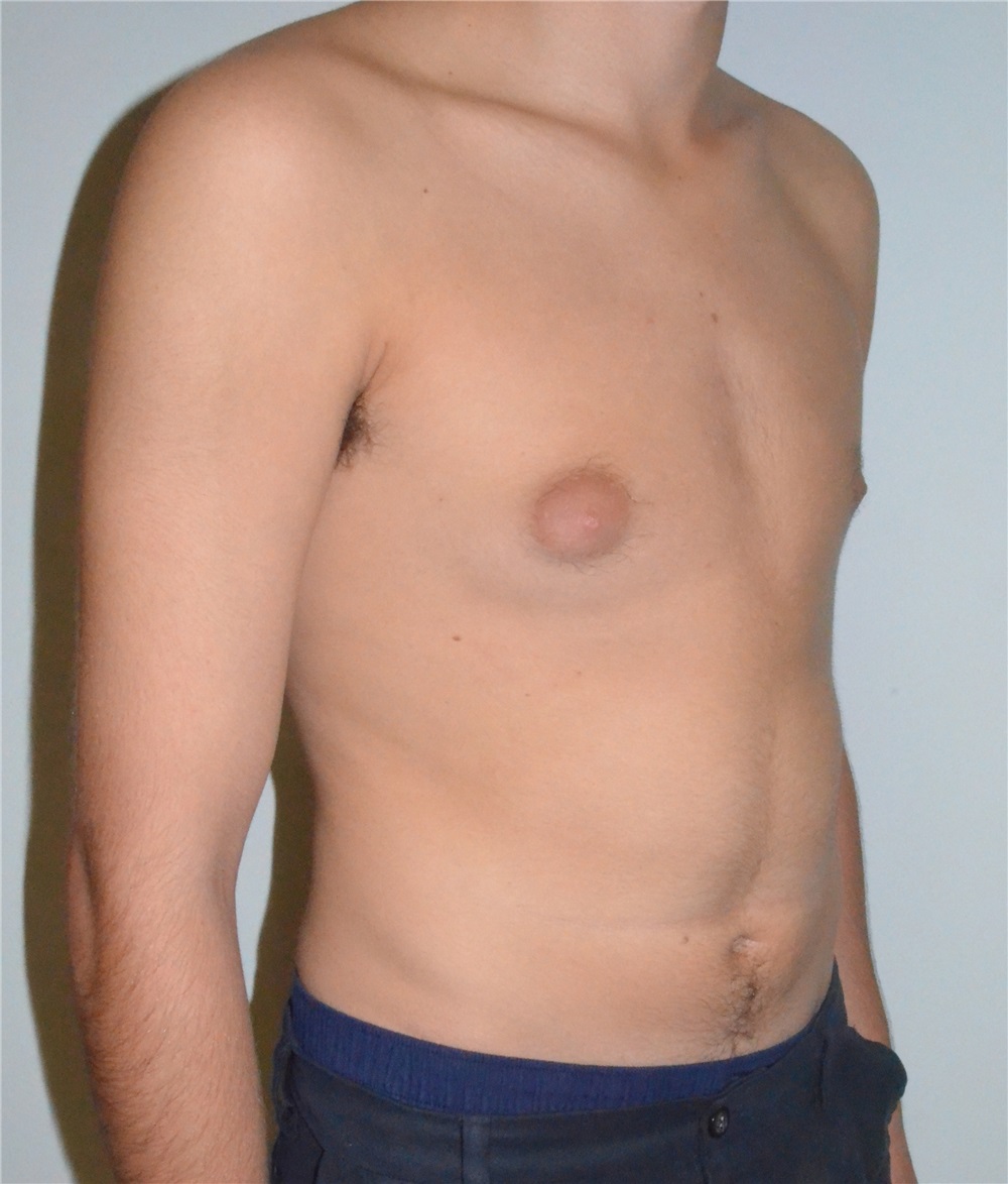 Hair loss alopecia permanent makeup