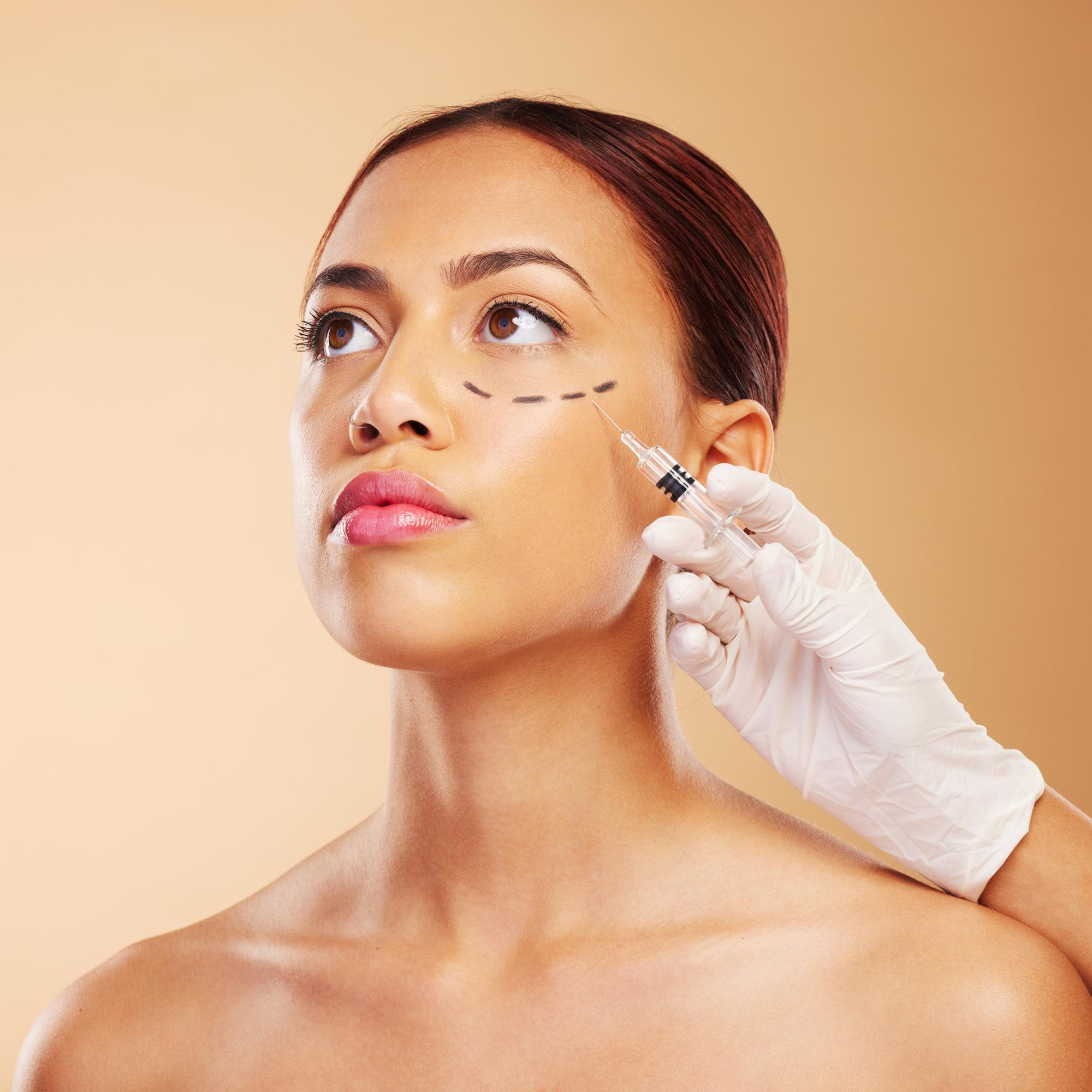 Cheek and midface dermal filler treatment