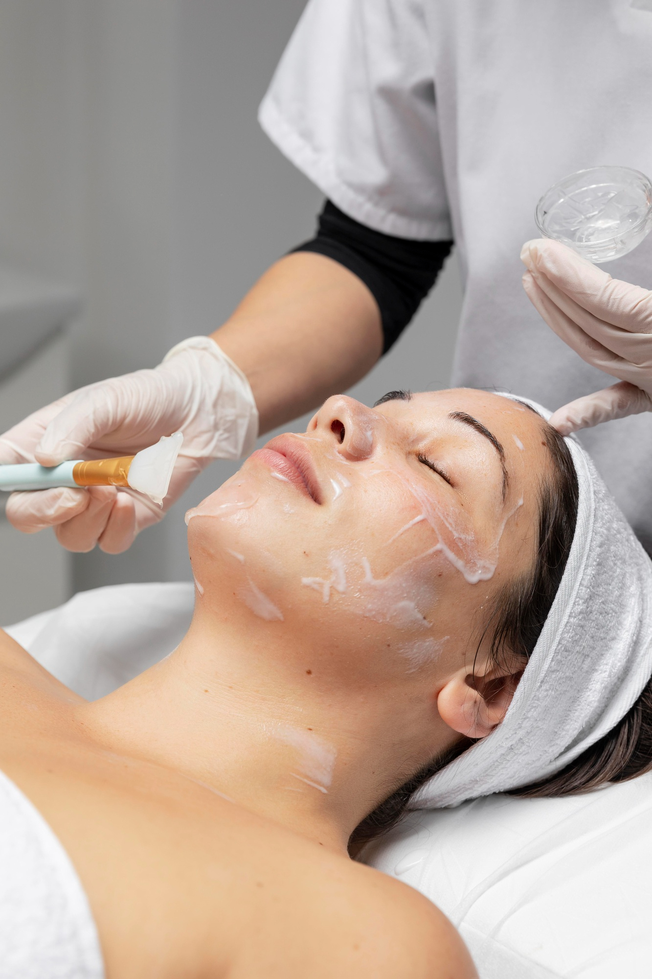 Chemical peel under eye pigmentation