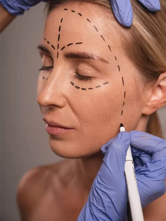 Liquid facelift combination treatment