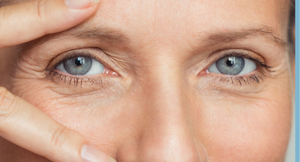 Sleep deprivation dark circles