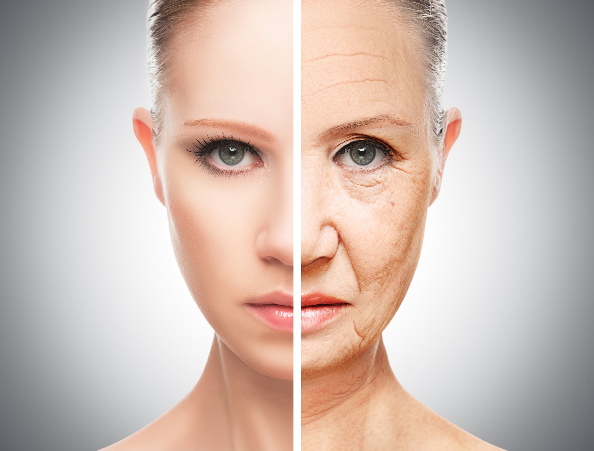 PDO thread lift non-surgical face lift