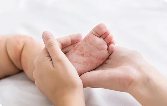 Skin infection diagnosis treatment