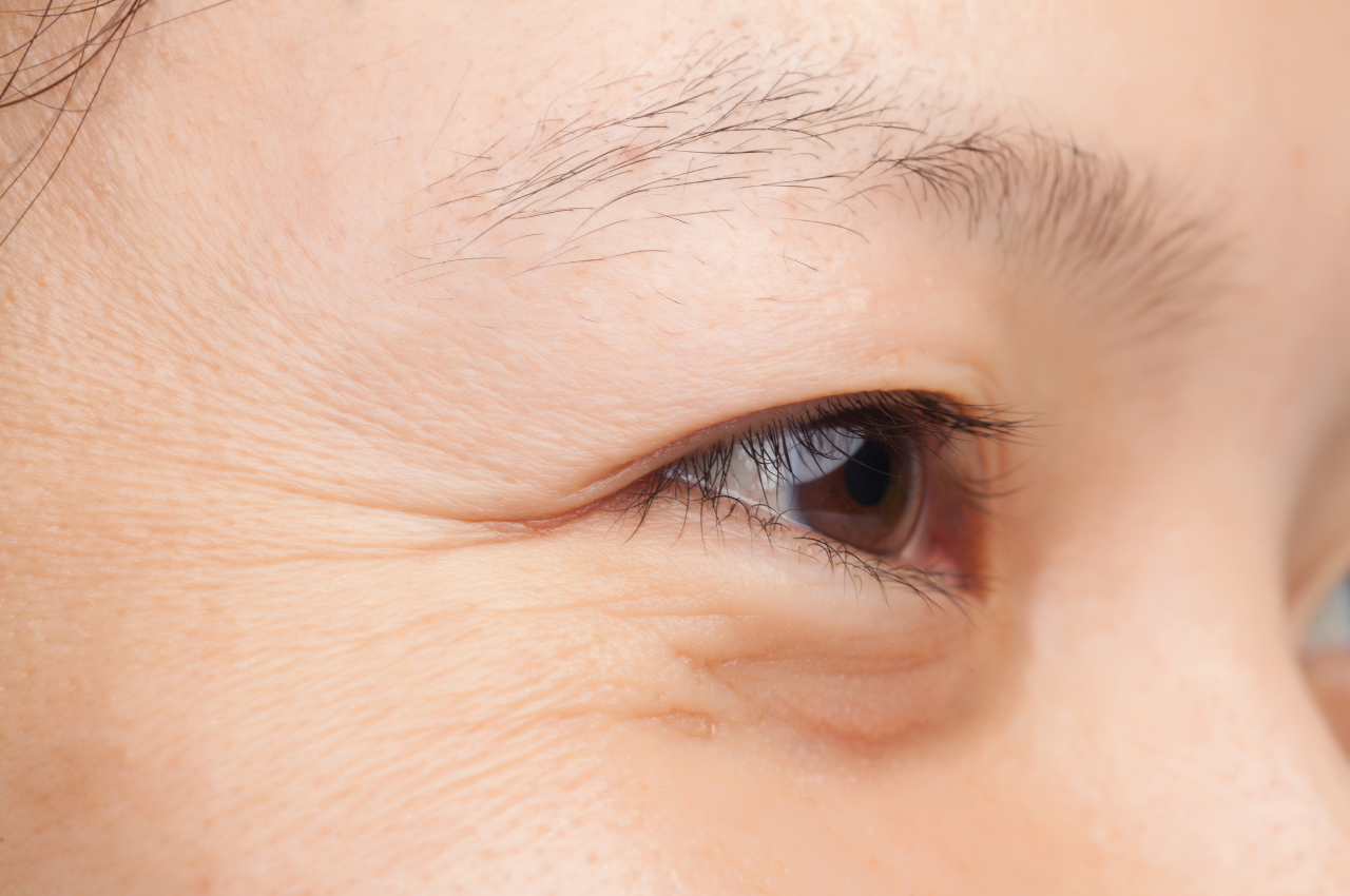 Lifestyle factors and skin ageing