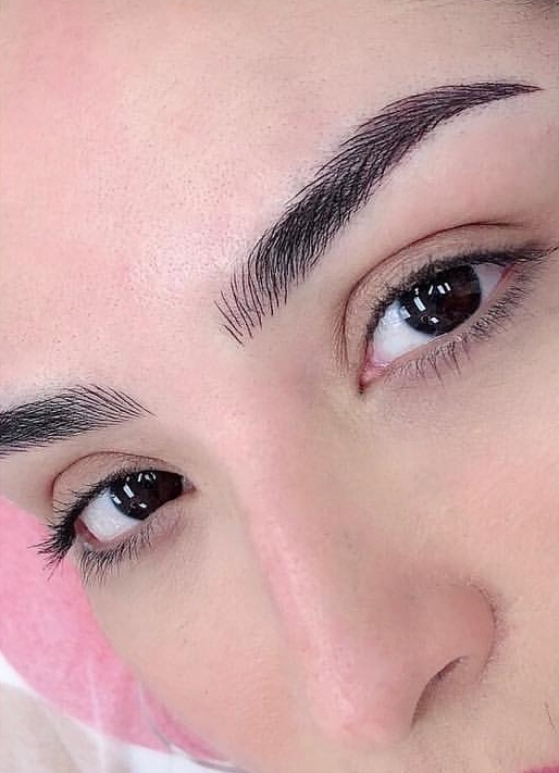 After treatment