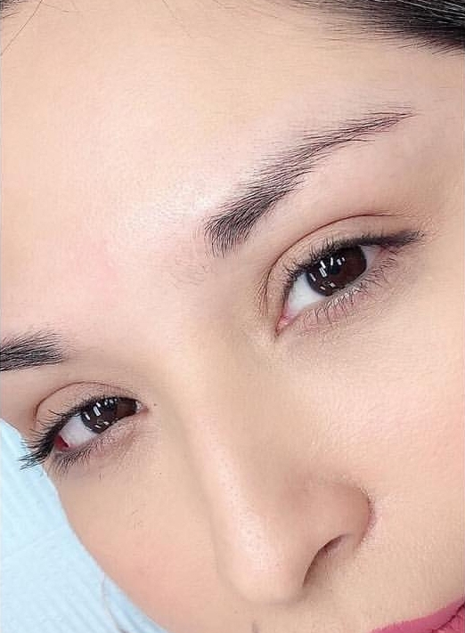 Before treatment