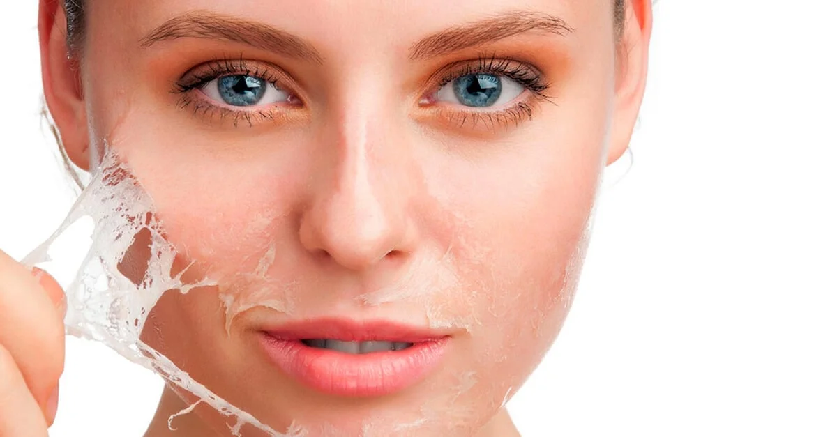 UV sun damage skin thickening