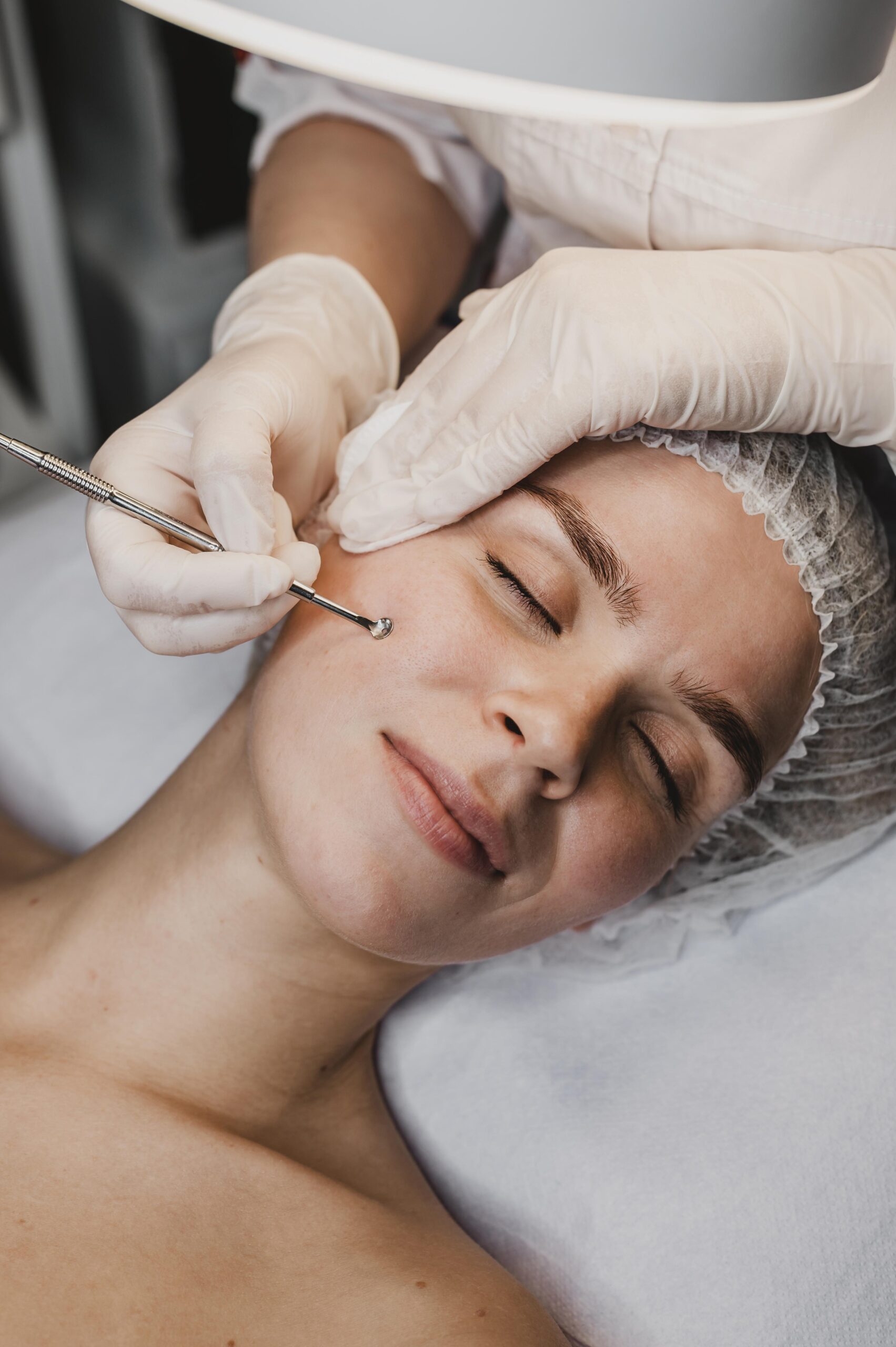 Subscision scar release procedure