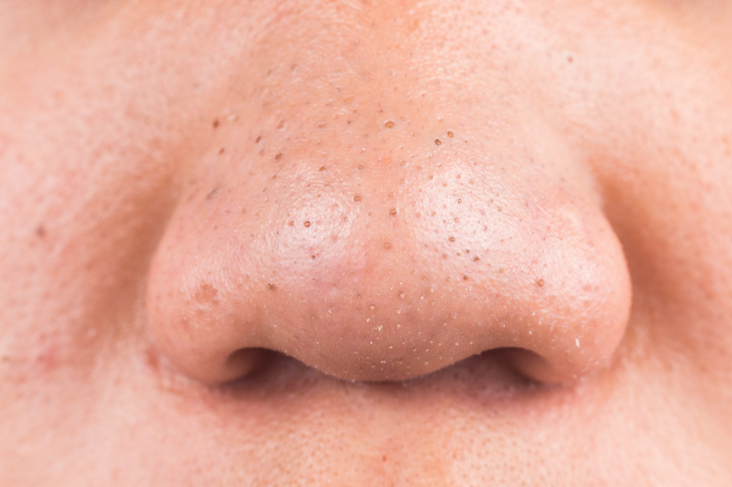 Clear, smooth skin close-up